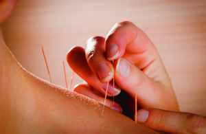ECH_acupuncture_widget