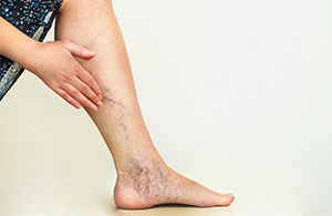 ECH_DeepVeinThrombosis_widget